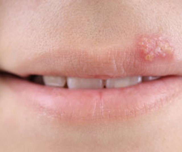 Nhận 'nụ hôn thần chết' từ người bạn của bố mẹ, bé gái tê liệt suốt 13 năm