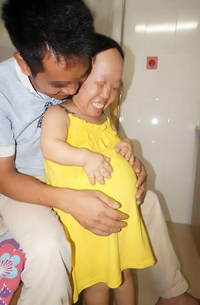 Bất chấp cảnh báo nguy hiểm, người phụ nữ lùn nhất thế giới vẫn kiên quyết mang thai