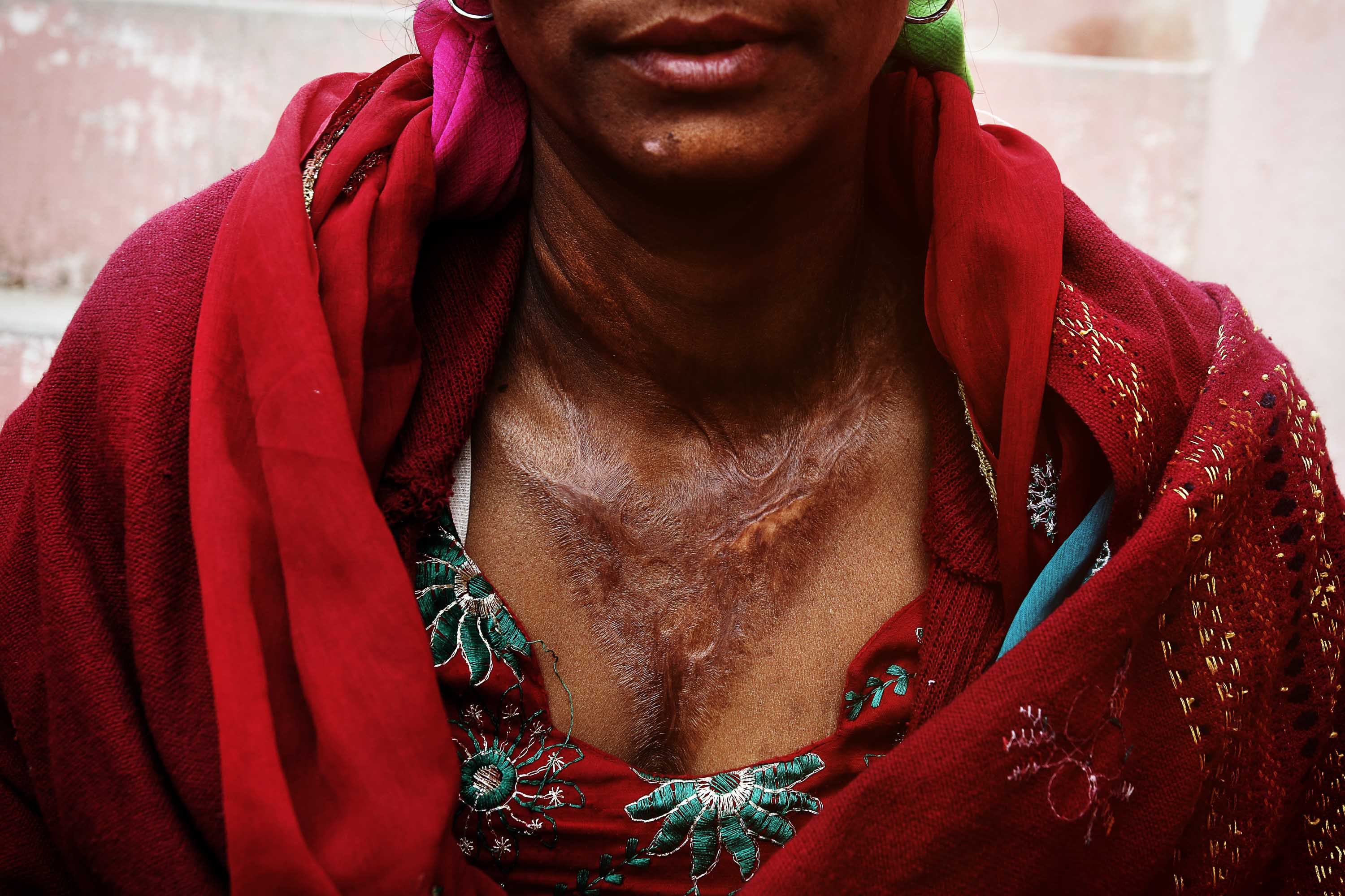 Hé lộ cuộc sống đầy tủi nhục của 'cô dâu 8 tuổi' ngoài đời thực