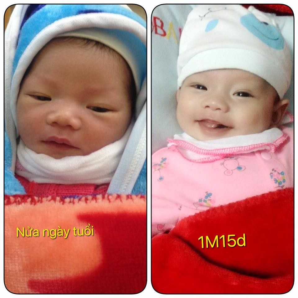 Con ra đời bị chê xấu, mẹ khoe ảnh bé lột xác sau vài tuần khiến nhiều người ngỡ ngàng