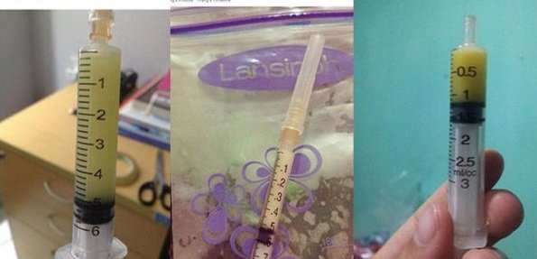 Mẹ ơi, xin đừng vì vài giọt sữa non mà đẻ con thiếu tháng