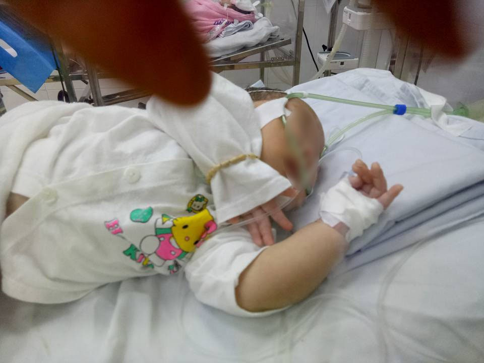 Cảnh báo: Con suy hô hấp nặng vì mẹ chủ quan không cho đi tái khám