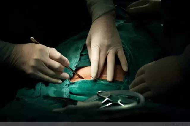 Tận mắt chứng kiến ca sinh mổ chân thật đến từng chi tiết mà mẹ nào cũng nên xem