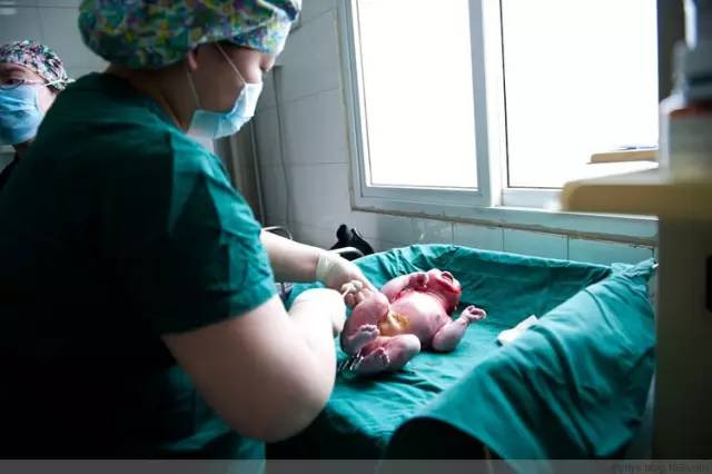 Tận mắt chứng kiến ca sinh mổ chân thật đến từng chi tiết mà mẹ nào cũng nên xem