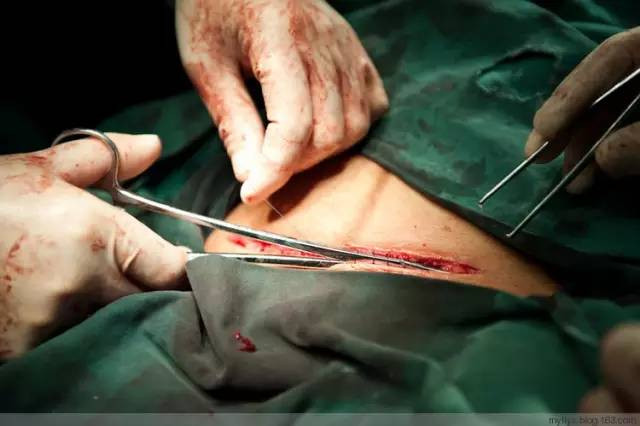 Tận mắt chứng kiến ca sinh mổ chân thật đến từng chi tiết mà mẹ nào cũng nên xem