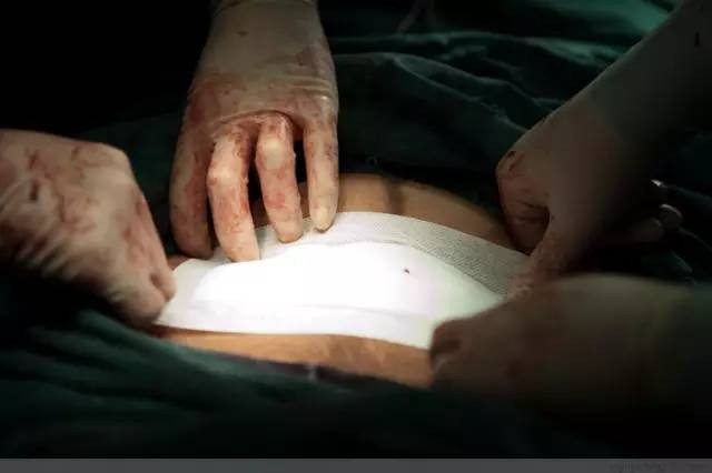 Tận mắt chứng kiến ca sinh mổ chân thật đến từng chi tiết mà mẹ nào cũng nên xem