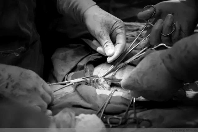 Tận mắt chứng kiến ca sinh mổ chân thật đến từng chi tiết mà mẹ nào cũng nên xem