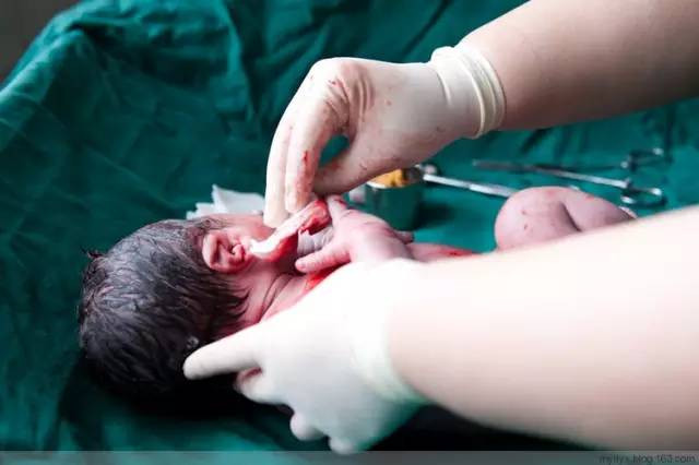 Tận mắt chứng kiến ca sinh mổ chân thật đến từng chi tiết mà mẹ nào cũng nên xem