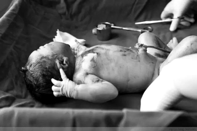 Tận mắt chứng kiến ca sinh mổ chân thật đến từng chi tiết mà mẹ nào cũng nên xem