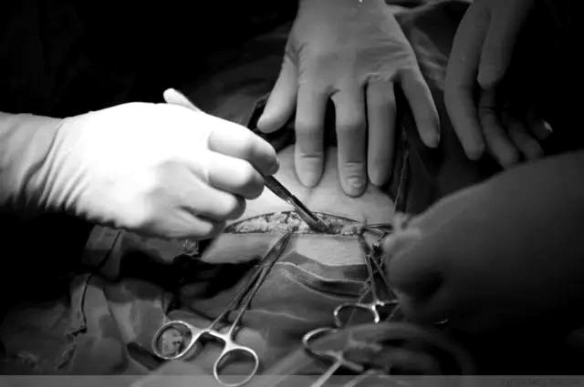 Tận mắt chứng kiến ca sinh mổ chân thật đến từng chi tiết mà mẹ nào cũng nên xem