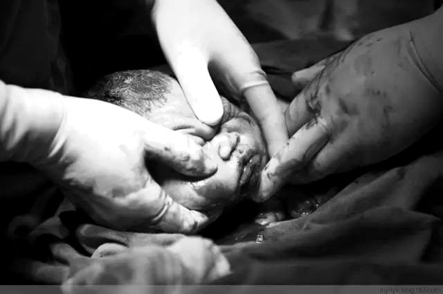 Tận mắt chứng kiến ca sinh mổ chân thật đến từng chi tiết mà mẹ nào cũng nên xem