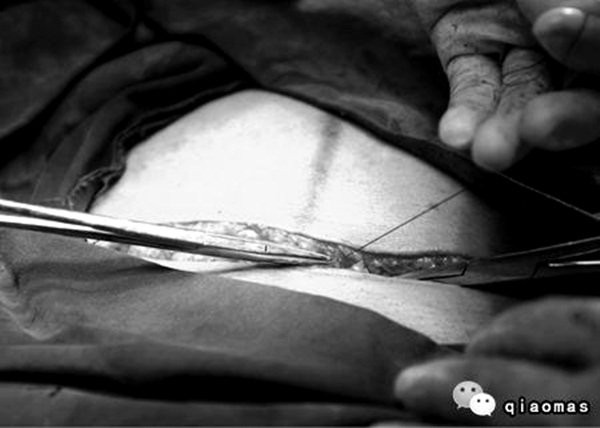 Tận mắt chứng kiến ca sinh mổ chân thật đến từng chi tiết mà mẹ nào cũng nên xem