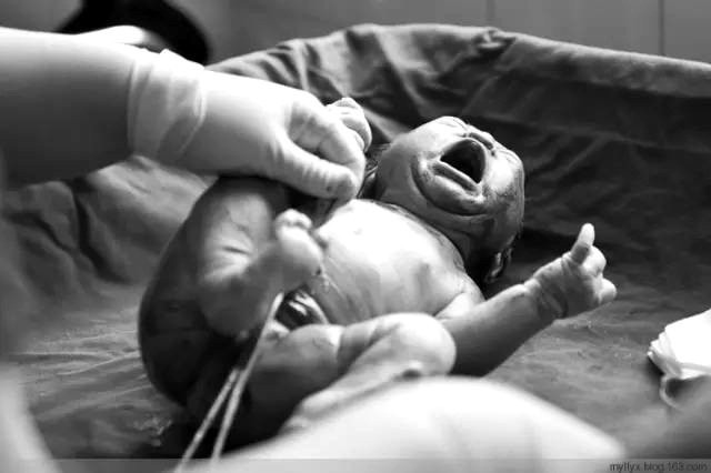 Tận mắt chứng kiến ca sinh mổ chân thật đến từng chi tiết mà mẹ nào cũng nên xem