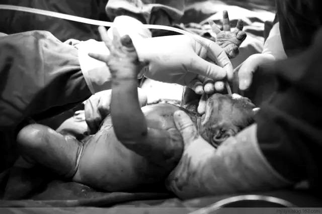 Tận mắt chứng kiến ca sinh mổ chân thật đến từng chi tiết mà mẹ nào cũng nên xem