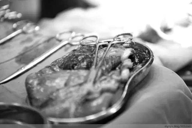 Tận mắt chứng kiến ca sinh mổ chân thật đến từng chi tiết mà mẹ nào cũng nên xem