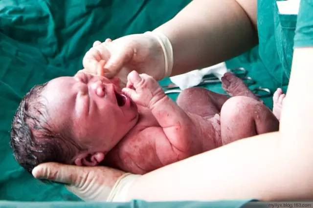 Tận mắt chứng kiến ca sinh mổ chân thật đến từng chi tiết mà mẹ nào cũng nên xem