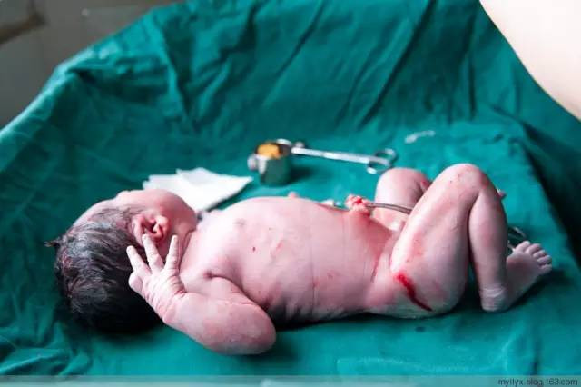 Tận mắt chứng kiến ca sinh mổ chân thật đến từng chi tiết mà mẹ nào cũng nên xem