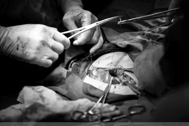 Tận mắt chứng kiến ca sinh mổ chân thật đến từng chi tiết mà mẹ nào cũng nên xem