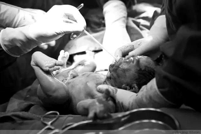 Tận mắt chứng kiến ca sinh mổ chân thật đến từng chi tiết mà mẹ nào cũng nên xem