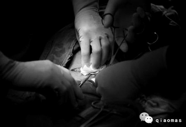 Tận mắt chứng kiến ca sinh mổ chân thật đến từng chi tiết mà mẹ nào cũng nên xem