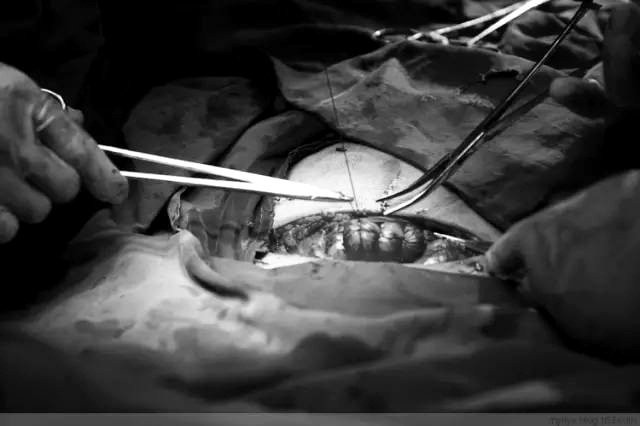 Tận mắt chứng kiến ca sinh mổ chân thật đến từng chi tiết mà mẹ nào cũng nên xem