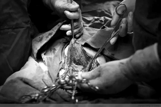 Tận mắt chứng kiến ca sinh mổ chân thật đến từng chi tiết mà mẹ nào cũng nên xem