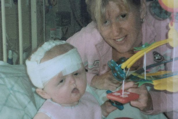 Mắc hội chứng Apert như bé Bôm, bé gái may mắn được tái sinh với khuôn mặt mới