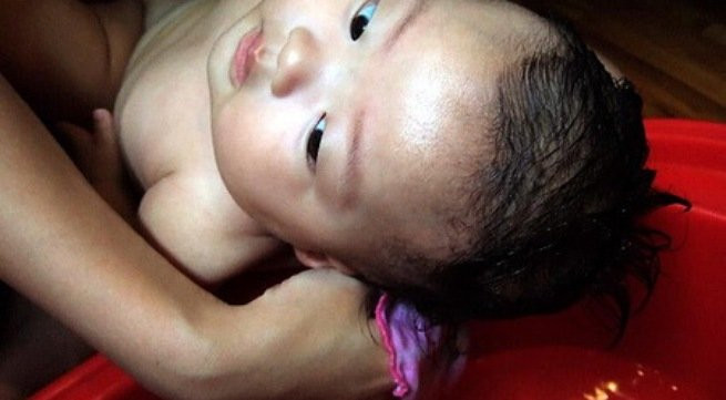 Xót xa mẹ gãi 'cứt trâu' cho con đến bong tróc cả mảng tóc, rộp đỏ da đầu