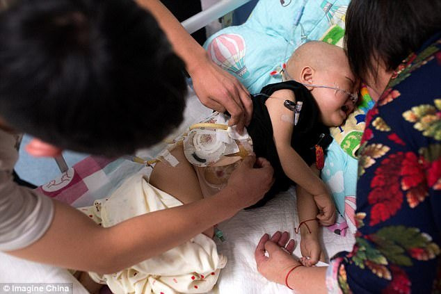 Xót đứt ruột bé trai 2 tuổi mắc ung thư gan bị mẹ nhẫn tâm bỏ rơi