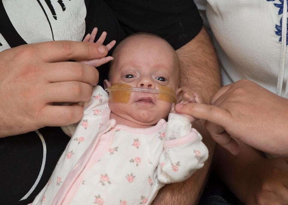 Sức sống kỳ diệu của em bé sinh non khi mới 25 tuần, cơ thể chỉ to bằng quả bóng tennis