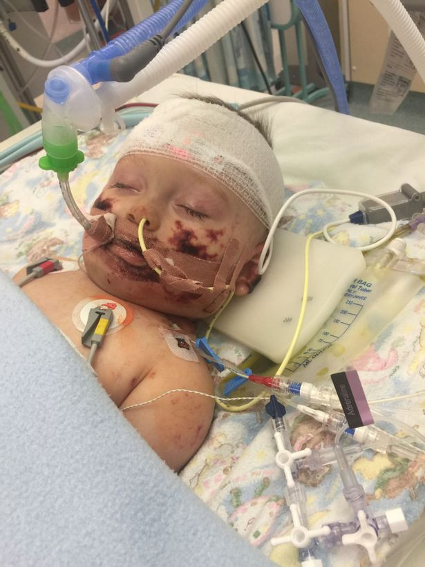 Cậu bé bị viêm màng não hồi phục kỳ diệu sau khi được chẩn đoán chỉ sống thêm vài giờ