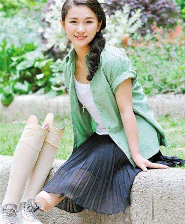 Cảm phục nghị lực phi thường của cô gái xinh đẹp cụt 2 chân, mất con, chồng bỏ đi