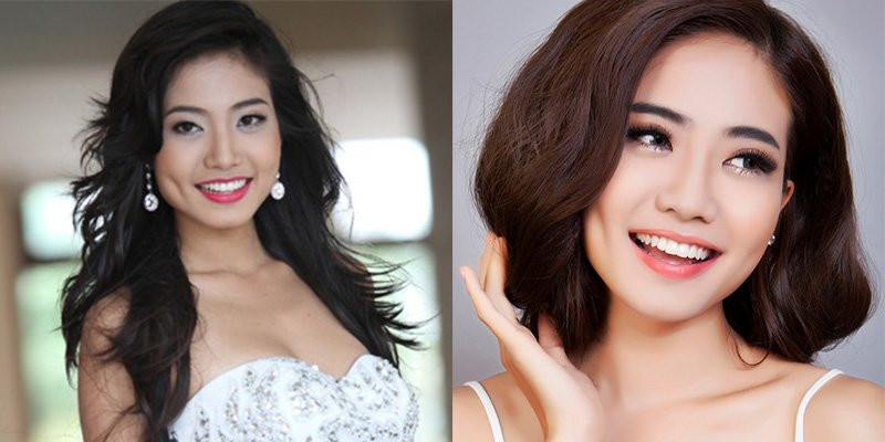 Thực hư phương pháp nắn xương thẩm mỹ để khuôn mặt thon gọn hơn đang được các sao ưa chuộng