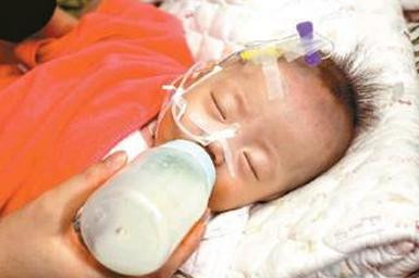 Bé sơ sinh 13 ngày tuổi bị hoại tử ruột vì mẹ pha sữa sai cách