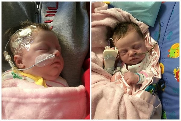 Bé gái sống sót kỳ diệu dù nứt bụng bẩm sinh, ruột nằm... ngoài bụng