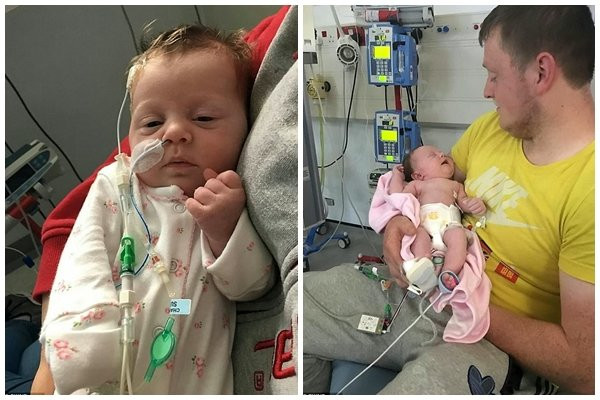 Bé gái sống sót kỳ diệu dù nứt bụng bẩm sinh, ruột nằm... ngoài bụng