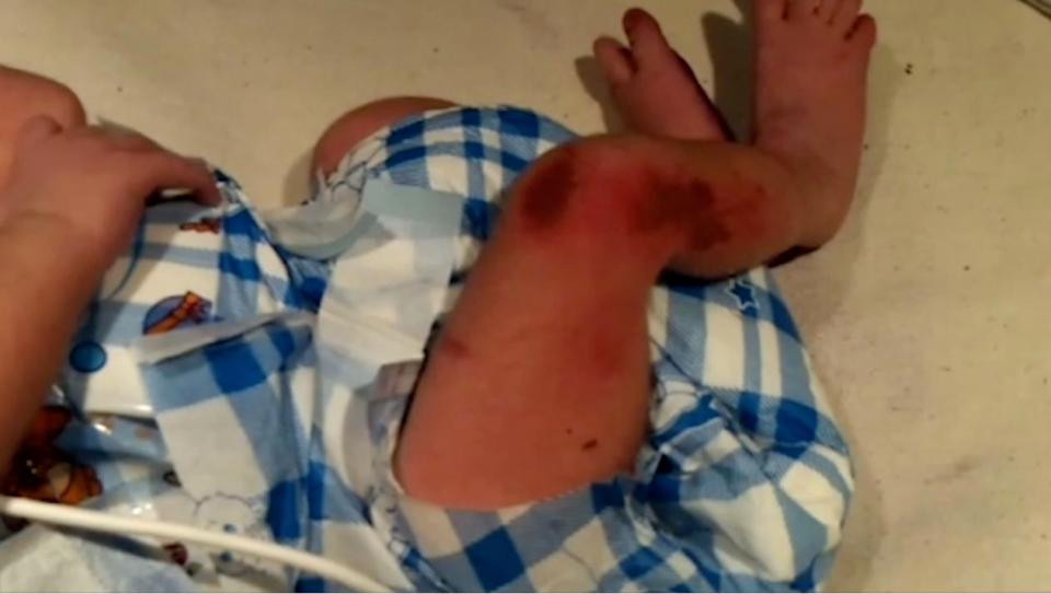 Ấn Độ: Thêm một bé gái bị bỏ rơi dã man trong thùng rác