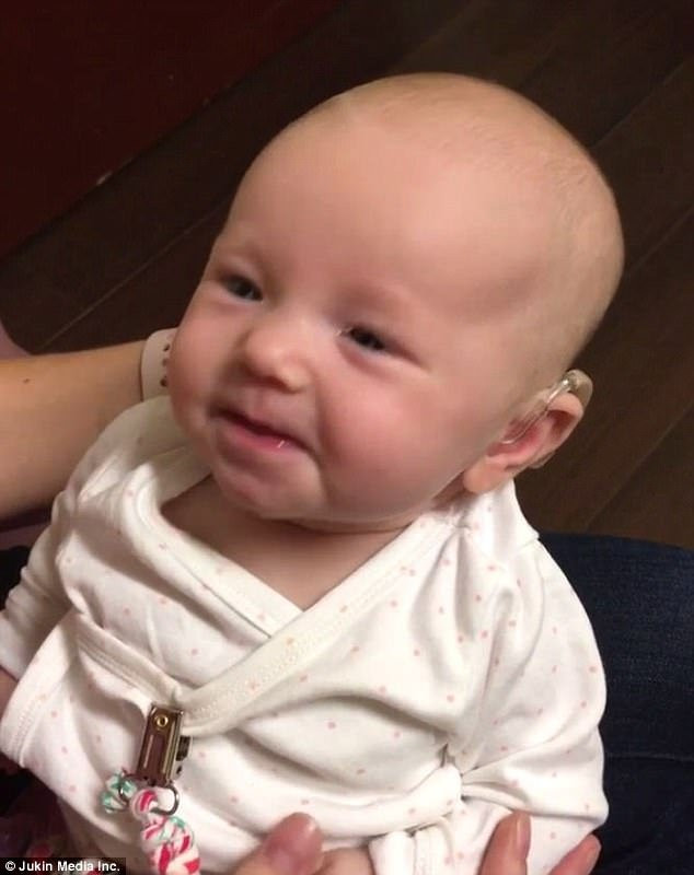 Xúc động khoảnh khắc em bé rớm lệ khi lần đầu nghe tiếng mẹ qua máy trợ thính