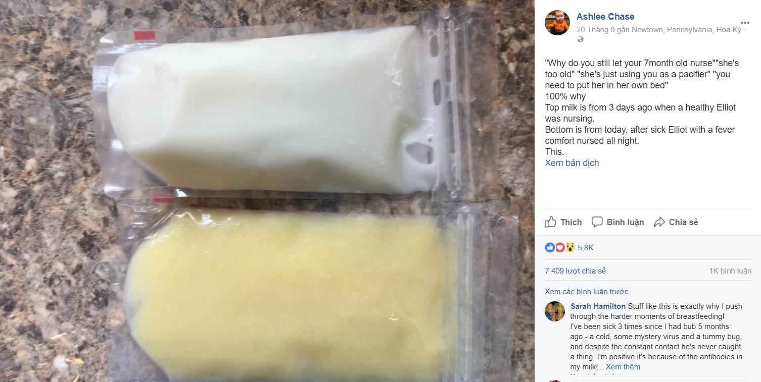 Bức ảnh 2 túi sữa mẹ khác màu được vắt cách nhau 3 ngày chứng minh sự kỳ diệu của sữa mẹ