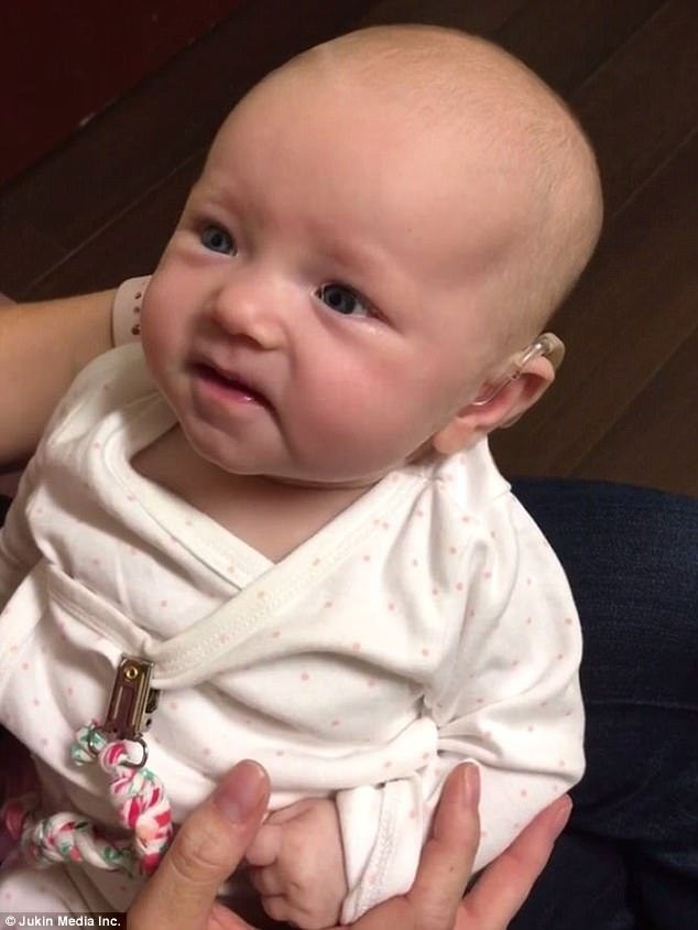 Xúc động khoảnh khắc em bé rớm lệ khi lần đầu nghe tiếng mẹ qua máy trợ thính