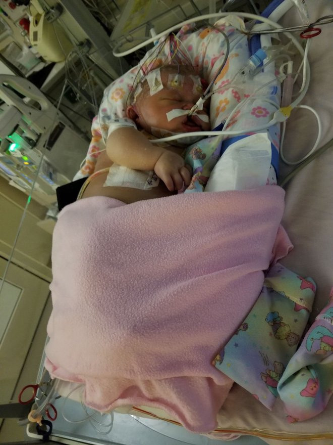 Được người nhà ôm hôn, em bé nhiễm virus viêm phổi