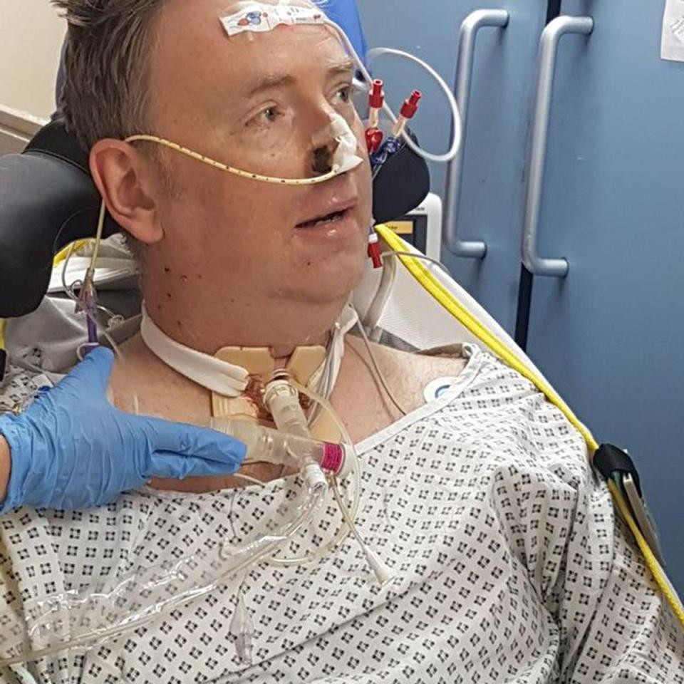 Bị cảm cúm, ông bố bị cắt cụt tứ chi suýt chết