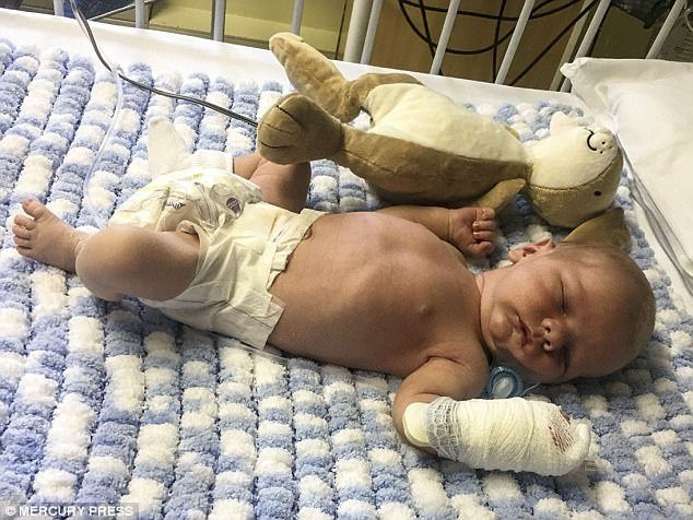 Được người nhà ôm hôn, em bé nhiễm virus viêm phổi