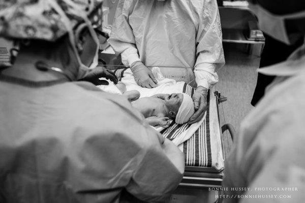 Xúc động người mẹ phải cắt một bên ngực vì ung thư vú vẫn cố cho con bú