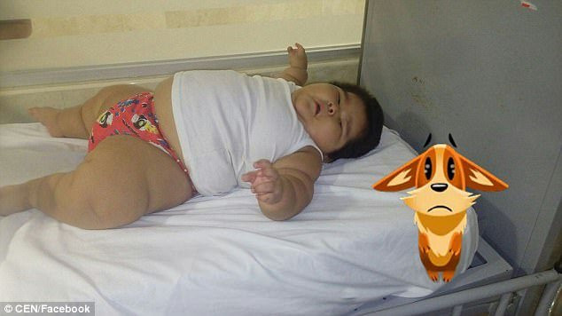 Sốc với cậu bé khổng lồ 10 tháng tuổi nặng tới 30kg