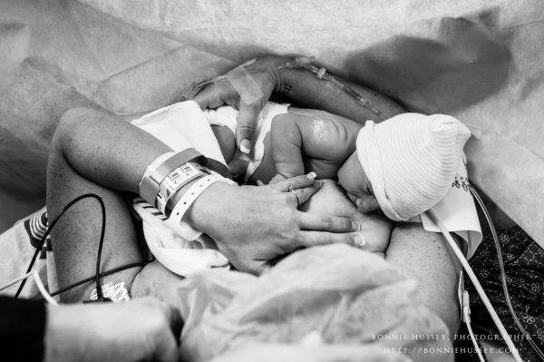 Xúc động người mẹ phải cắt một bên ngực vì ung thư vú vẫn cố cho con bú