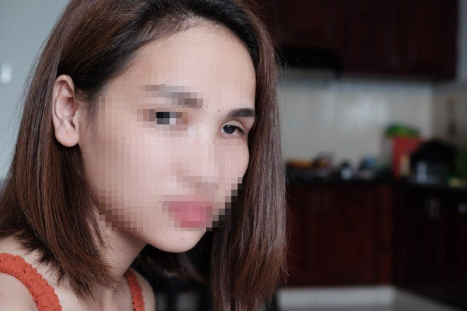 Cô gái mù mắt trái sau khi tiêm filler: “Không có bạn trai, tôi đã không gắng gượng được đến lúc này” - Ảnh 7. Cô gái mù mắt trái sau khi tiêm filler: “Không có bạn trai, tôi đã không gắng gượng được đến lúc này” - Ảnh 7.