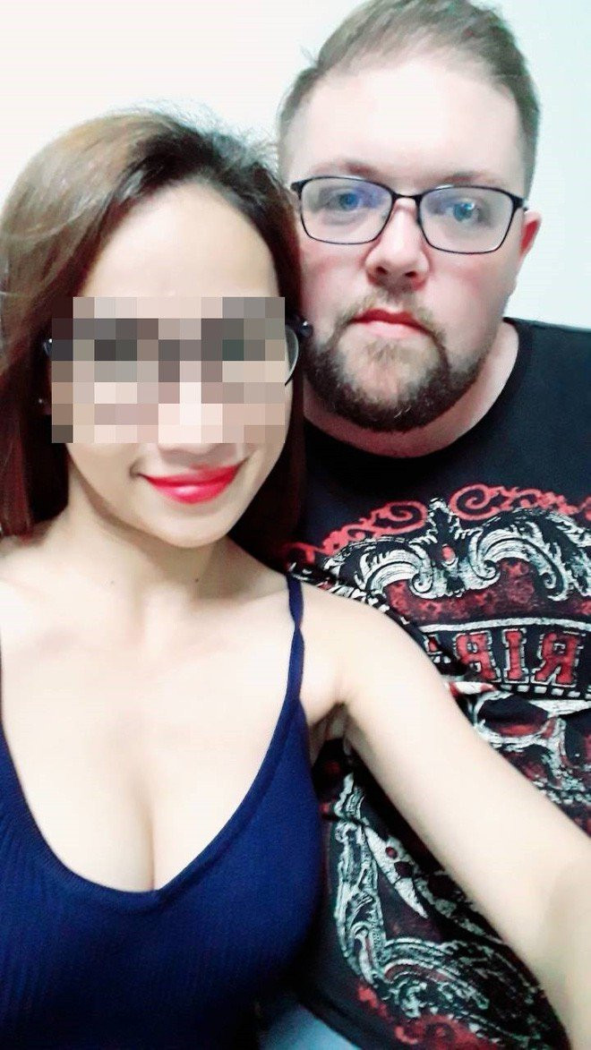 Cô gái mù mắt trái sau khi tiêm filler: “Không có bạn trai, tôi đã không gắng gượng được đến lúc này” - Ảnh 11. Cô gái mù mắt trái sau khi tiêm filler: “Không có bạn trai, tôi đã không gắng gượng được đến lúc này” - Ảnh 11.