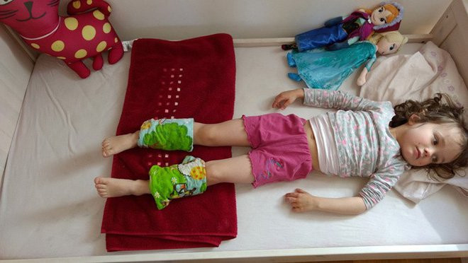 Buộc khăn bắp chân - Phương pháp hạ sốt cho con của mẹ Đức, các mẹ đã biết chưa? - Ảnh 1.