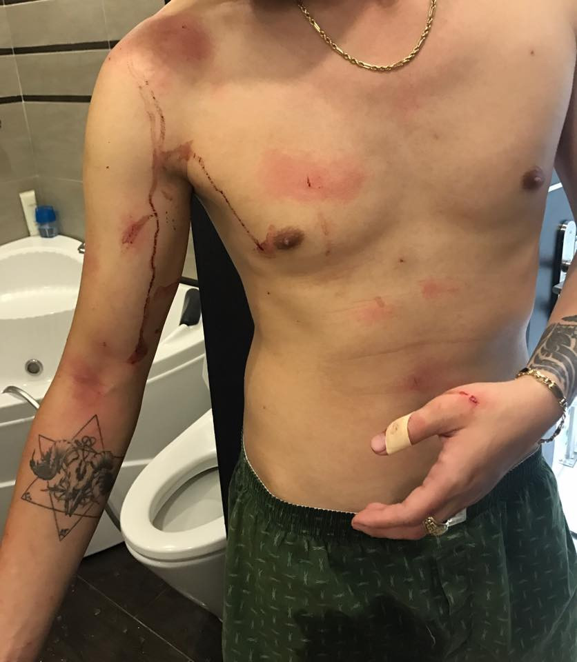 20245685_1208092496003855_9172591045334746517_n